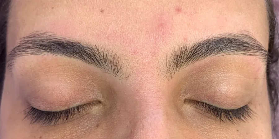 Caso 3, depois: sobrancelhas só com os pelos naturais.
